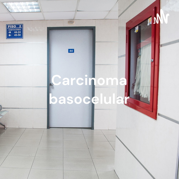 Artwork for Carcinoma basocelular
