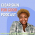 Clear Skin For Good | Tips Clearing Acne Without Cutting Out More Foods