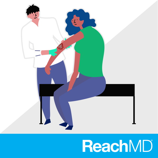 Artwork for DermConsult