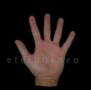 Artwork for eterogeneo