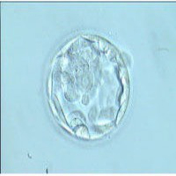 Artwork for Fecundación in Vitro