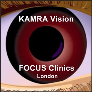 Artwork for KAMRA Vision London