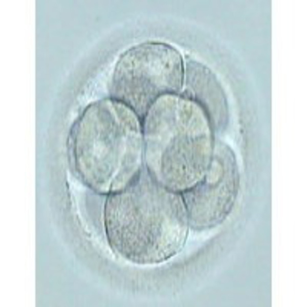 Artwork for La Fecundación in Vitro explicada con sencillez