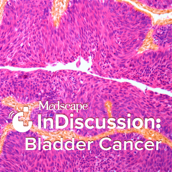 Artwork for Medscape InDiscussion: Bladder Cancer