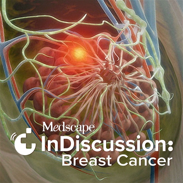 Artwork for Medscape InDiscussion: Breast Cancer