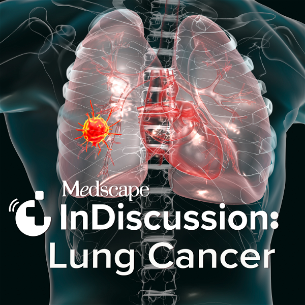 Artwork for Medscape InDiscussion: Lung Cancer