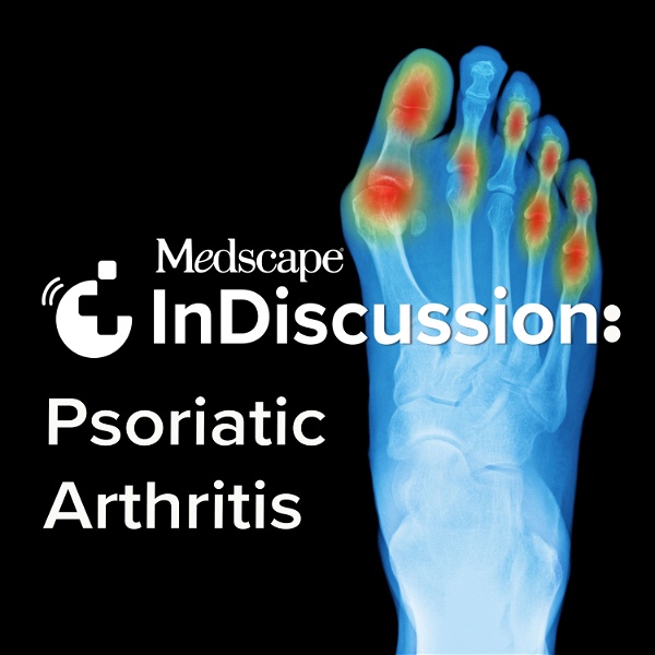 Artwork for Medscape InDiscussion: Psoriatic Arthritis