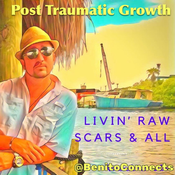 Artwork for Post Traumatic Growth- A guide to Livin' Raw Scars & All