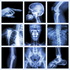 رادیوگرافی فارسی Radiography Farsi
