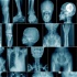 Radiology Update