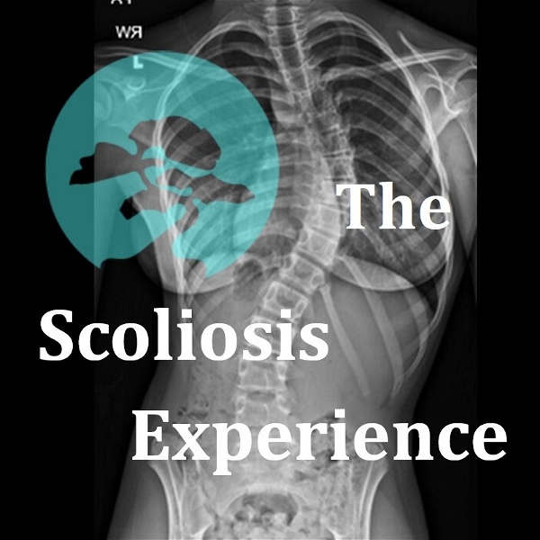 Artwork for The Scoliosis Experience