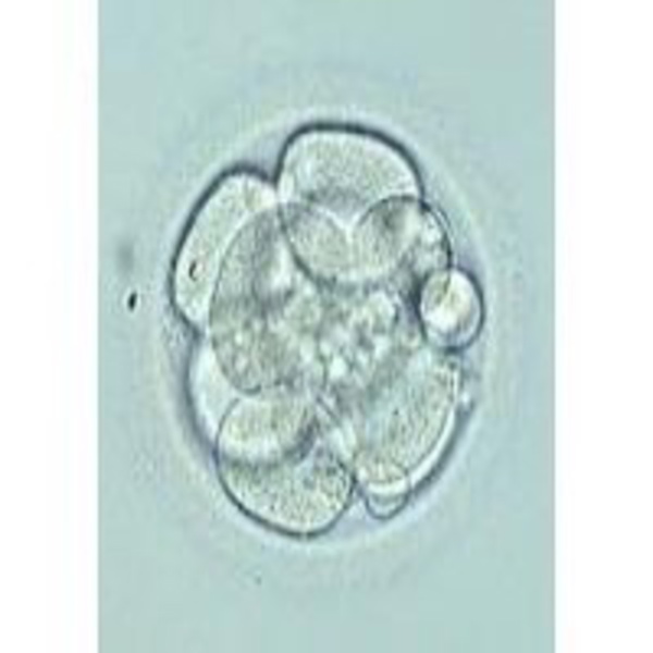 Artwork for Vitrificación embriones. Tipos de embriones