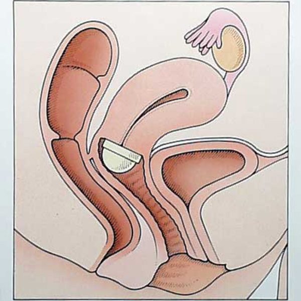 Artwork for With The Pale Foot Alternate