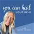 You Can Heal Your Skin
